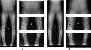 پیشگامی مرکز تصویربرداری راد در تشخیص ناهنجاریهای اندام تحتانی با هوش مصنوعی