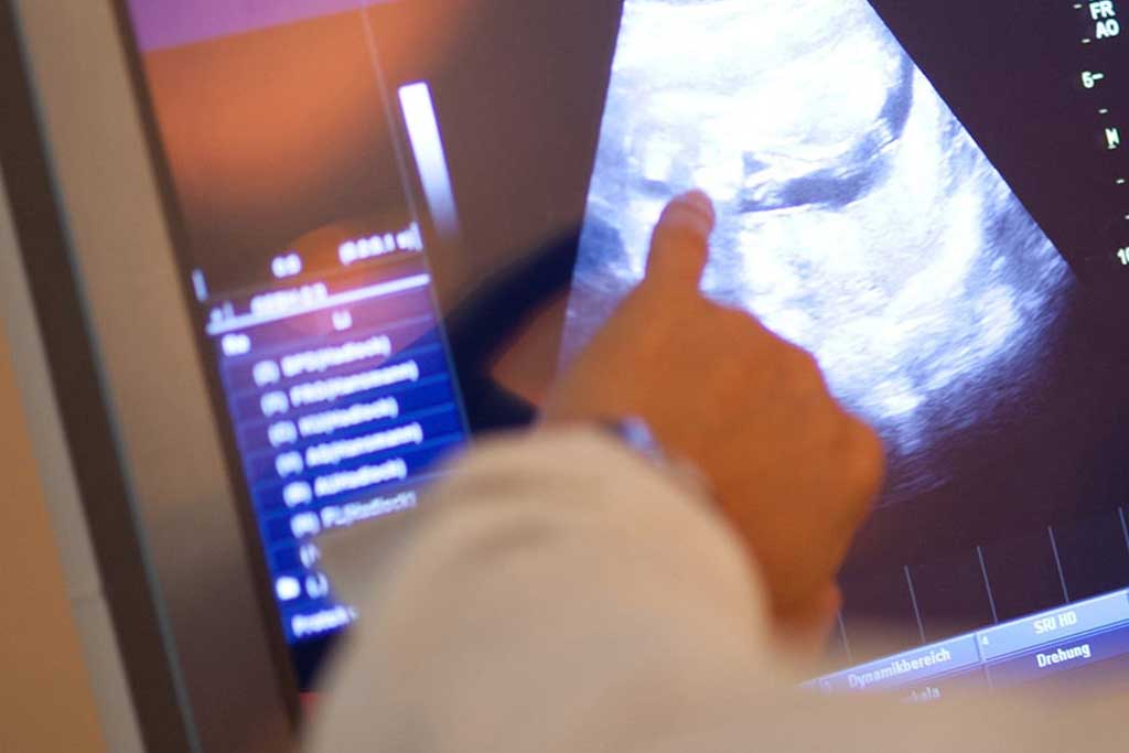 عکس رنگی رحم (HSG): بررسی لولههای رحمی و رحم، برای تشخیص نازایی