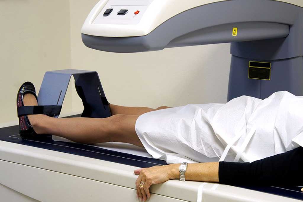 سن آزمایش تراکم استخوان؛ راهنمای زمانبندی و غربالگری