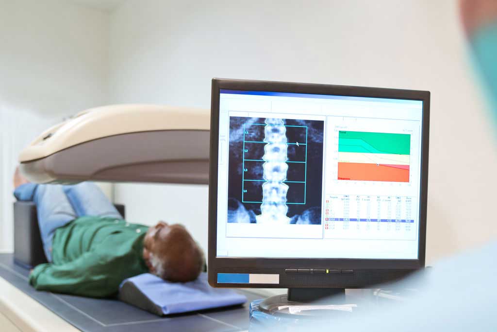 راهنمای آمادگی سنجش تراکم استخوان یا تست DEXA