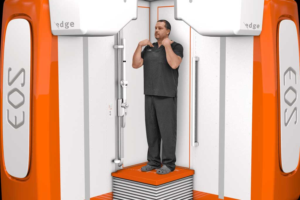 رادیوگرافی EOS: دوز پایین، کاربردها و راهکار جایگزین در مرکز رادیولوژی و سونوگرافی راد