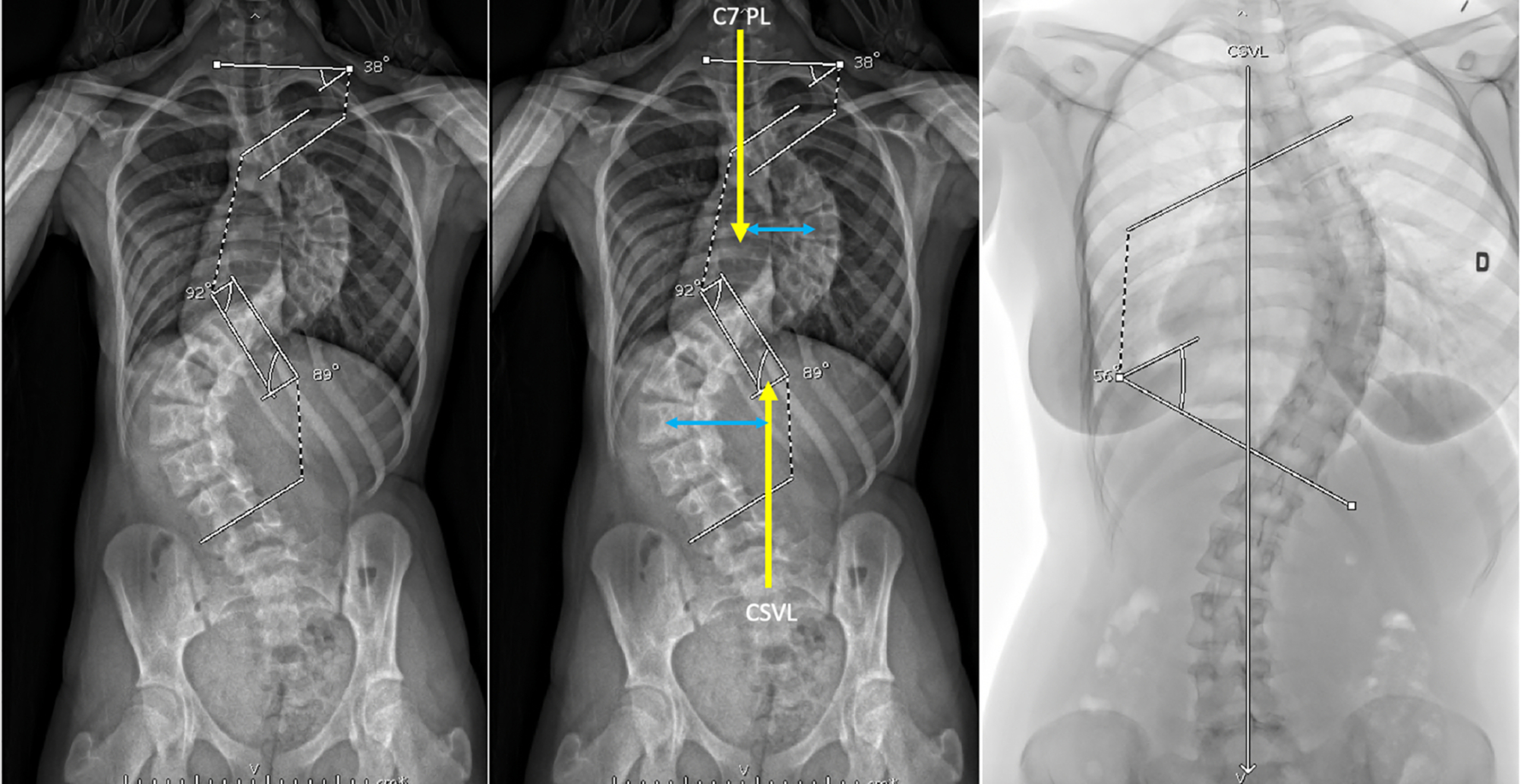 تفسیر تصاویر توتال اسپاین