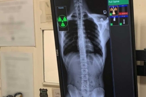 رادیولوژی فول اسپاین در تهران: روش، کاربردها و نقش آن در درمان اختلالات ستون فقرات