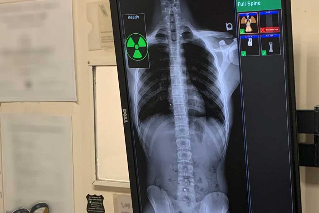 رادیولوژی فول اسپاین در تهران: روش، کاربردها و نقش آن در درمان اختلالات ستون فقرات