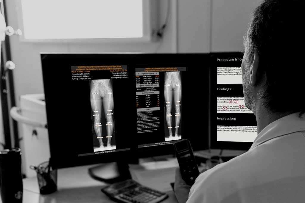 رادیوگرافی اندام تحتانی با دقت بالا: نکاتی که باید برای بررسی انحرافات پا و ستون فقرات رعایت کنید