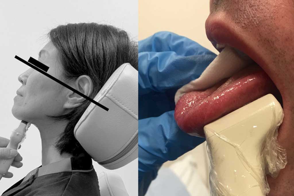 سونوگرافی زبان: کاربردها، مزایا و اهمیت در تشخیص بیماریهای دهانی