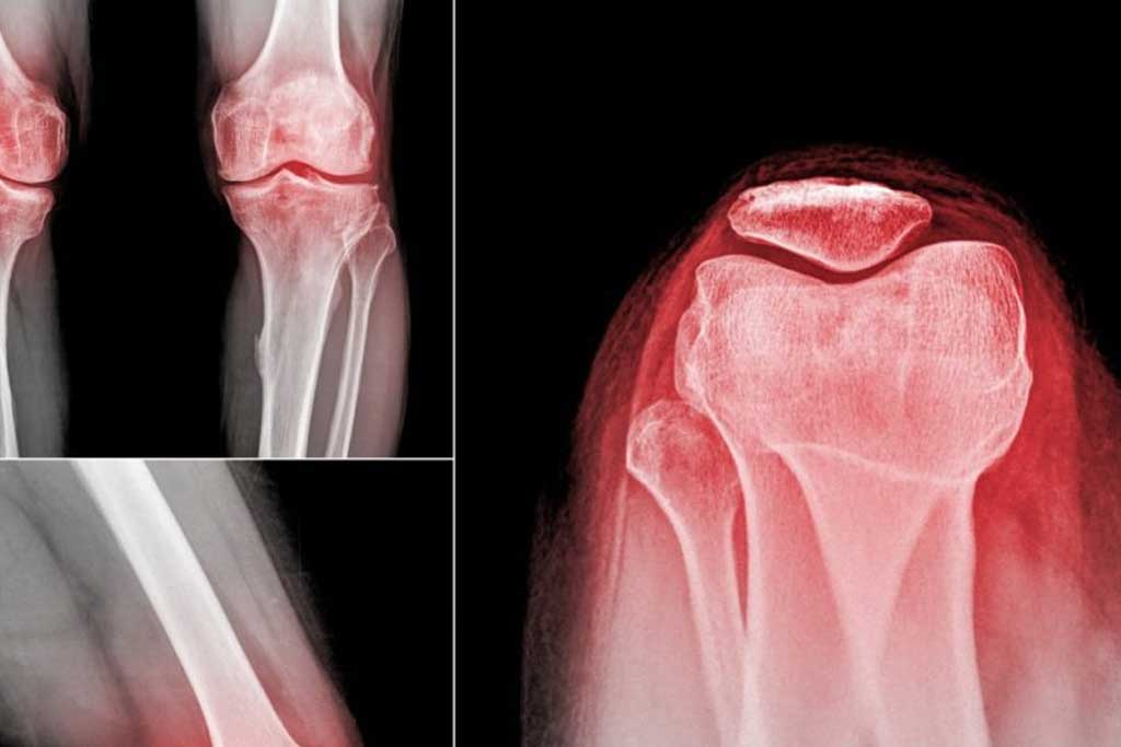 رادیوگرافی تری جوینت چیست؟ تصویربرداری همزمان از مفصل ران، زانو و مچ پا