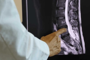 تصویر توتال اسپاین: بهترین روش برای بررسی انحرافهای اسکلتی