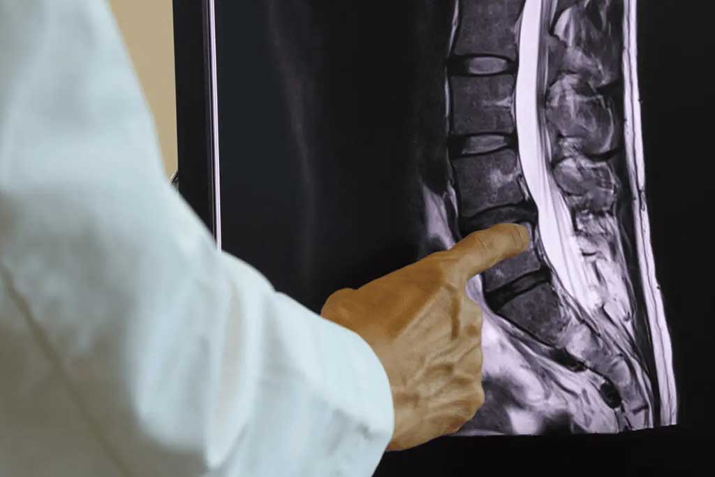 تصویر توتال اسپاین: بهترین روش برای بررسی انحراف‌های اسکلتی