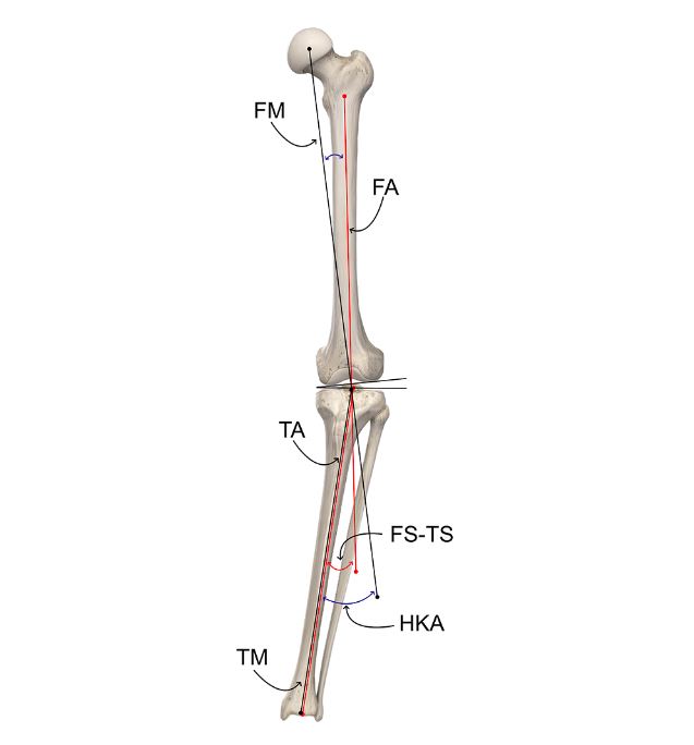 محور مکانیکی واریوس