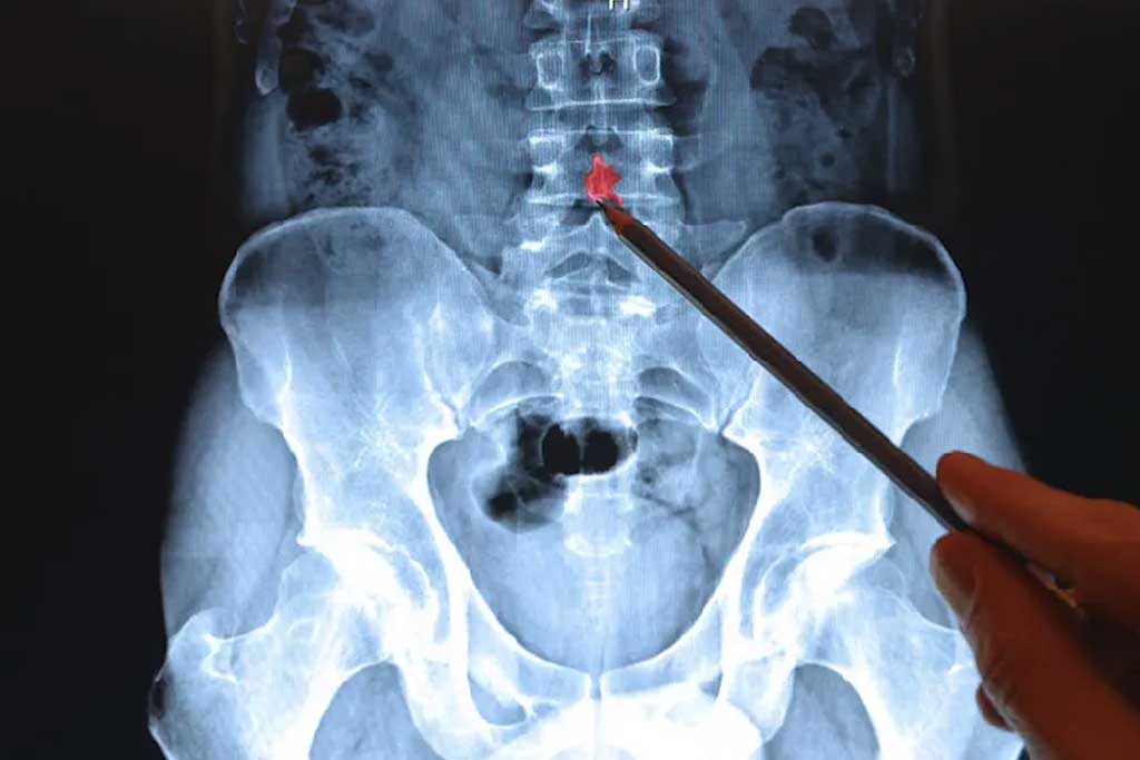 راهنمای جامع رادیوگرافی ستون فقرات تمامقد (Full Spine Radiography)