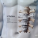 رادیوگرافی مهرههای لومبار (Lumbar Spine X-Ray)