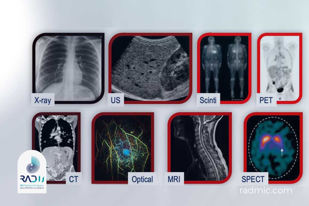 مدالیته (Imaging Modality) در رادیولوژی