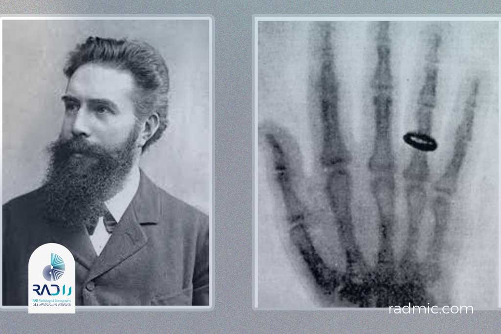 ویلهلم کنراد رونتگن (Wilhelm Conrad Röntgen) نخستین تصویر رادیوگرافی تاریخ را از دست همسرش، آنا برتا رونتگن، گرفت.