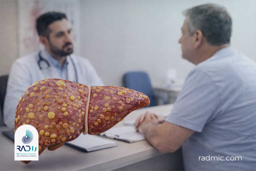 بیماری کبد چرب