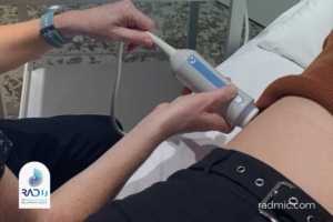 فیبرواسکن چیست؟